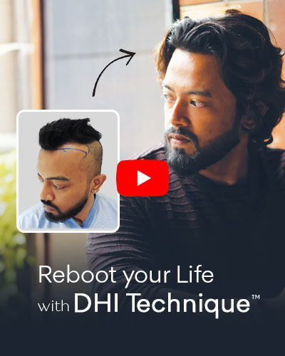 hair transplant in india